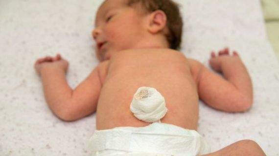 ¿Cuando se cae el cordón umbilical de tu bebé?