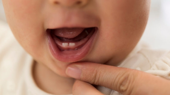 ¿Cómo calmar el dolor de dientes de un bebé?
