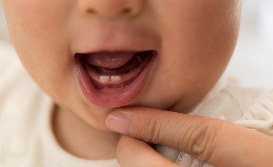 ¿Cómo calmar el dolor de dientes de un bebé?